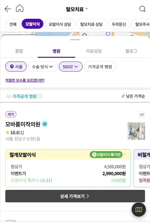 모두닥 모발이식 서비스 화면